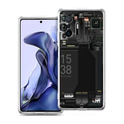 Enhanced Circuit Board Design Transparent Phone Case, Soft and Stylish for Xiaomi 11T pro (B1)