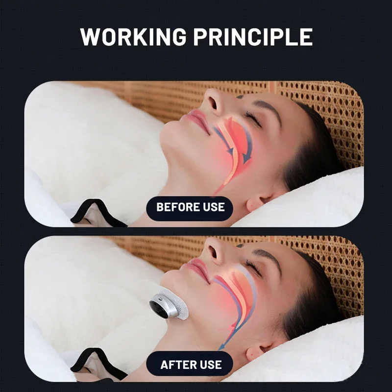 Smart Anti-Snoring Device TENS Pulse Snore Stopper Portable Sleep Aid Health Noise Reduction for Improved Sleep Quality