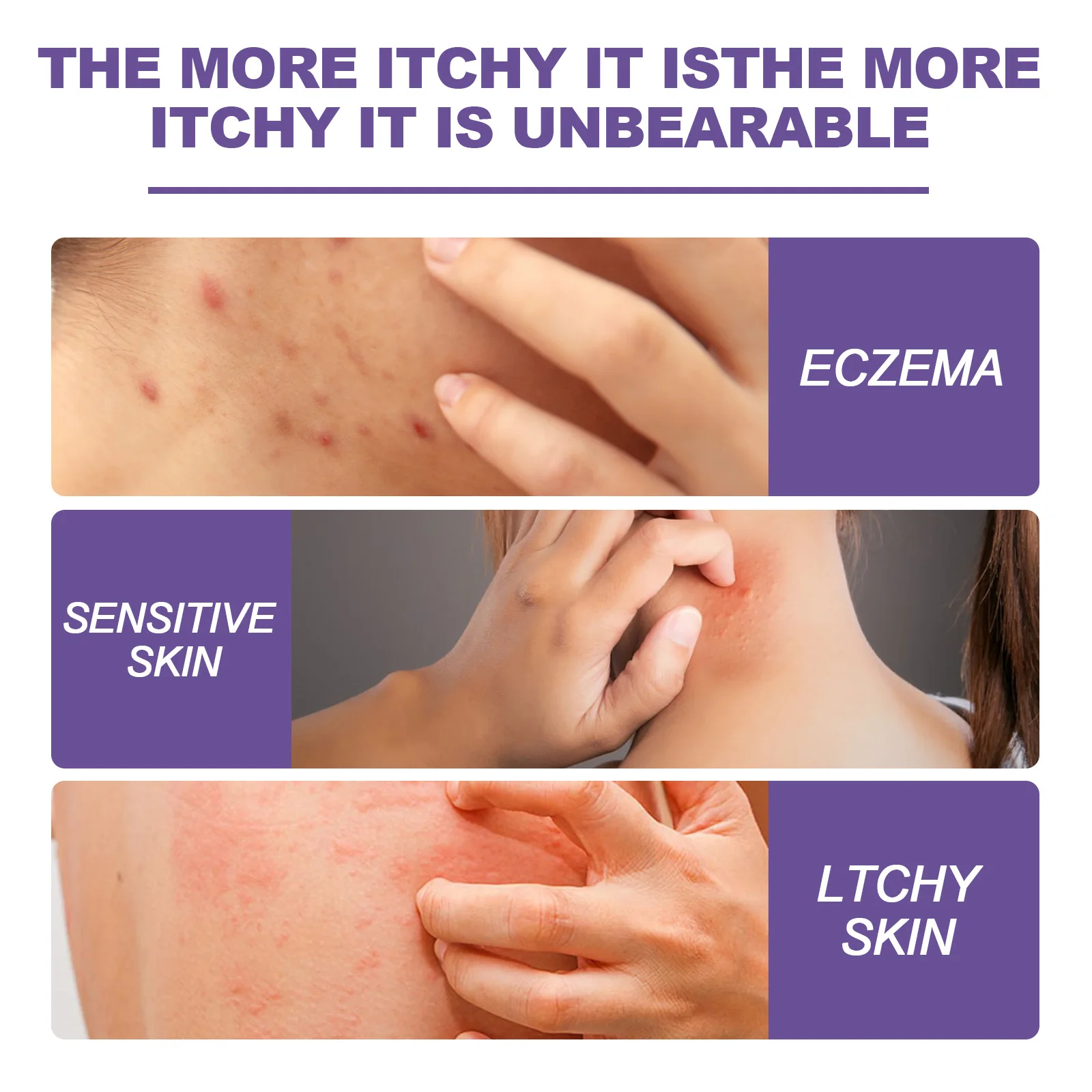 Рисунок 3 - Восстанавливающий крем от псориаза