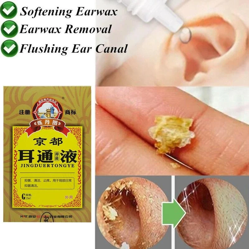 Ear Acute Otitis Drops Chinese Herbal Medicine For Ear Tinnitus
