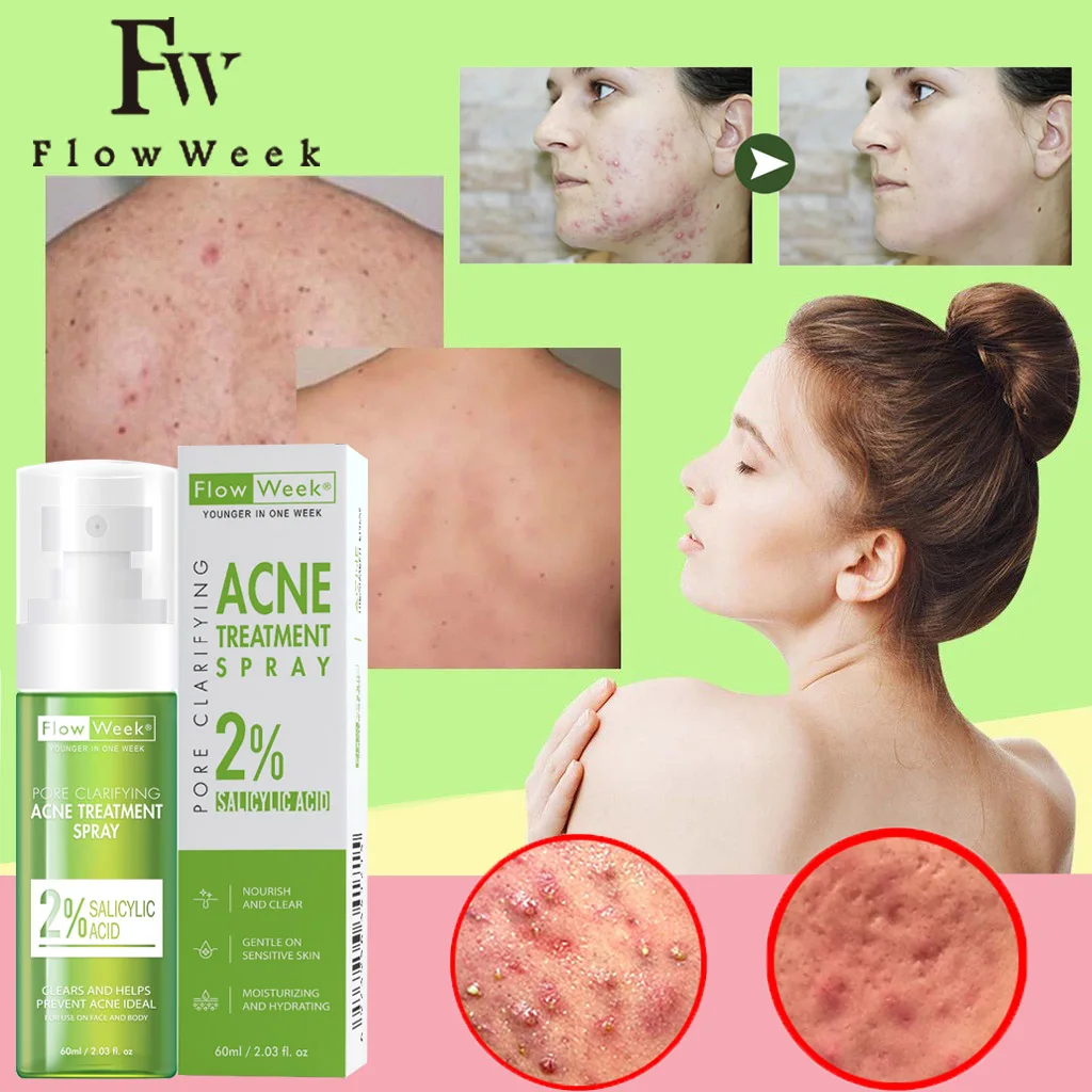 Flow Week Acne removing spray Back & Body Acne Spray Back Acne Treatment Organic For Body Acne Treatment Skin Care flow week anti wrinkle cream bosein anti aging firming lifting fade fine line face cream moisturizing nourish skin care