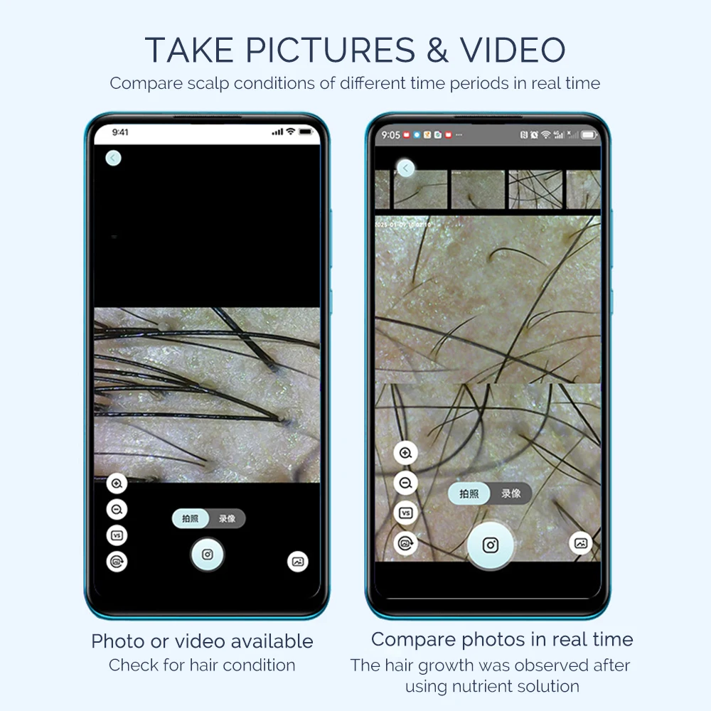 Portable Hair Follicle Scalp Detector 50X/200X Magnifying Pore Magnifier Mini Skin And Hair Eetector Skin Analyzer Skin Tester