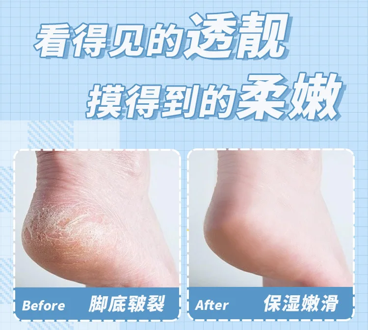 250g Vaseline Body Cream Niacinamide Petroleum Jelly Moisturizing Body Lotion Improve Skin Dehydration Hydrating Face Cream 6