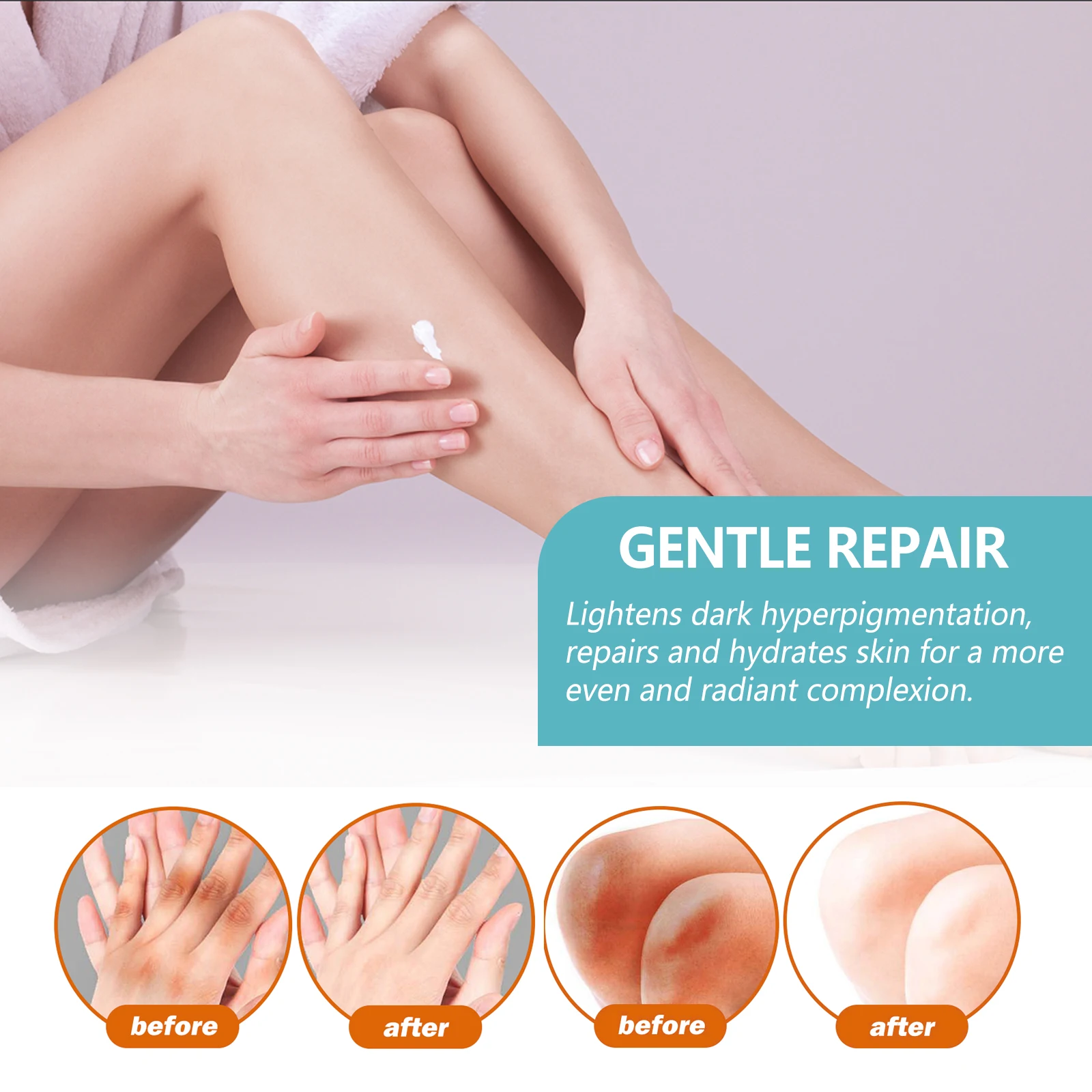 EELHOE Whitening Cream Brightening Skin For Dark Skin Neck Arm Knee Joint Underarm Body Care Acanthosis Nigricans Therapy Cream 4