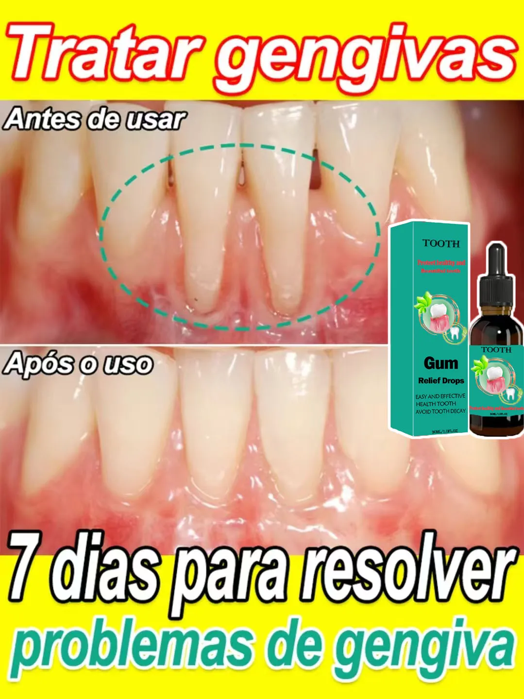 Repararel problema de las enc&iacute;as da&ntilde;adas,aliviar dolor,fortalecer problema de las enc&iacute;asy restaurar el la suciedad