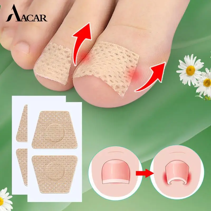 

2 шт./лист, ортопедические Пластыри для восстановления ногтей