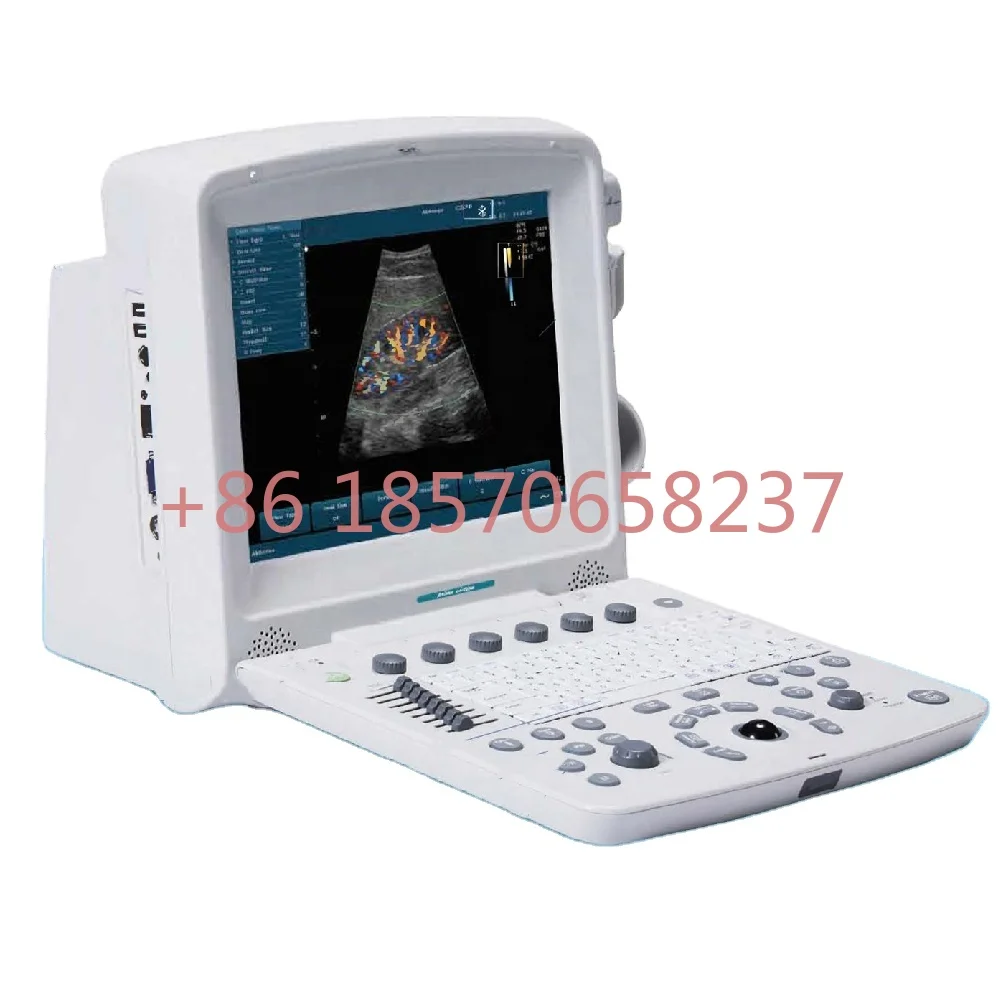 Macchina Scanner Edan U50 Ecografo Ultrasonido Laptop Color Doppler Portatile Ad Ultrasuoni Prezzo