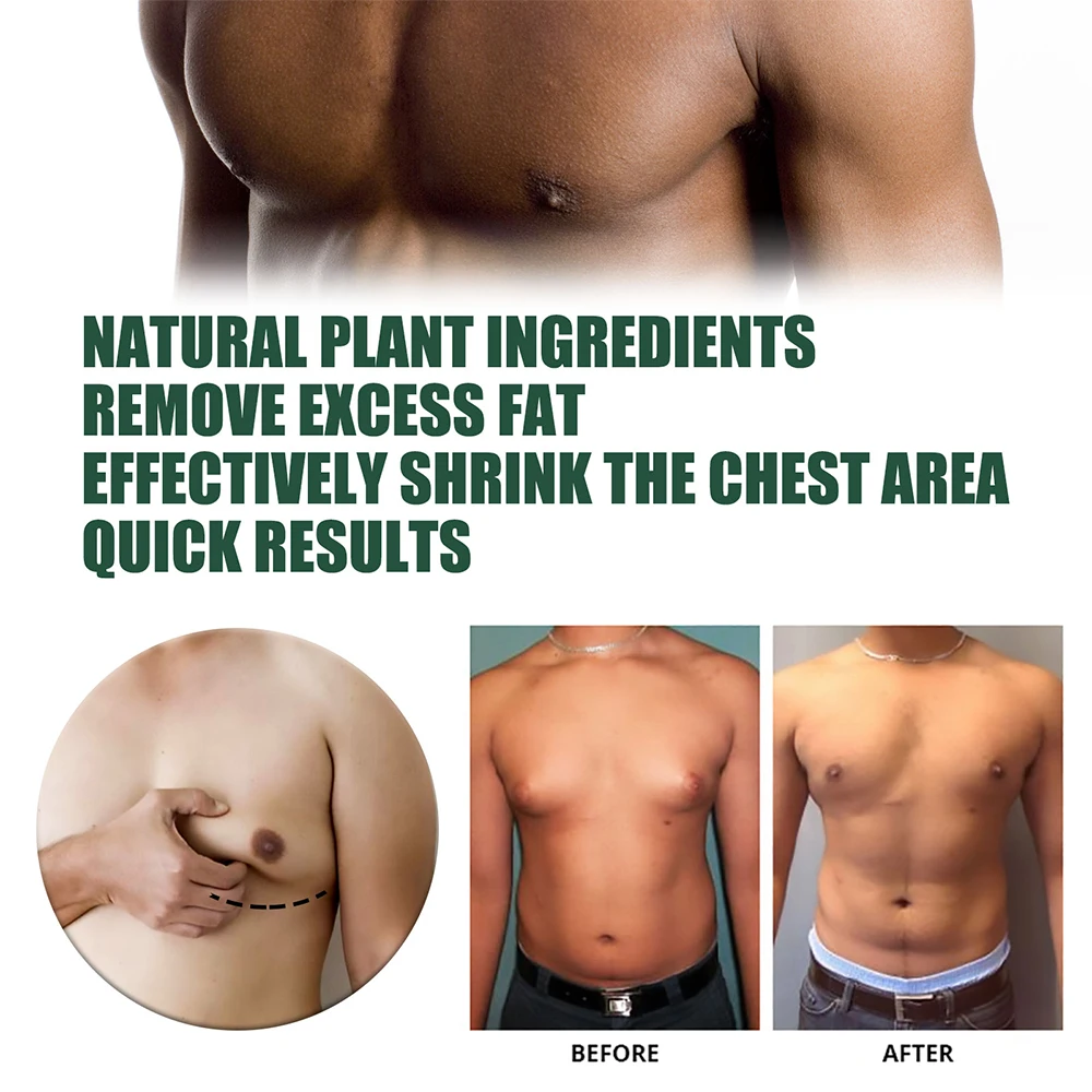 Breast Enlargement Cream Weight Loss Cream Man Breast Firm Massage Ginger Serum Remove Excess Fat Shrink Chest Gynecomastia Tighten 30ml