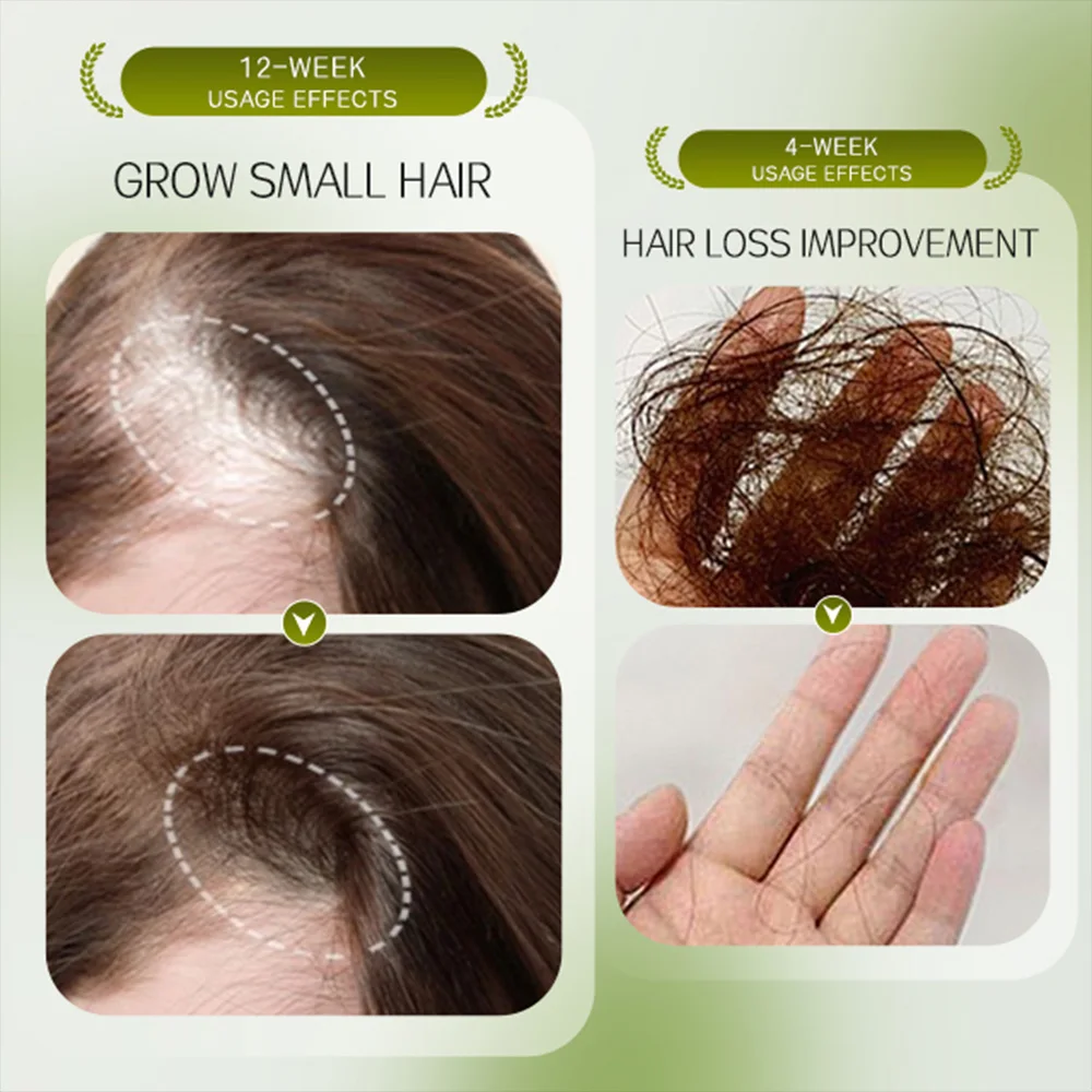 HAIRAROUSE Hair Serum Scalp Treatment, Improves Hair Volume, Strength Roots Reduce loss Herbal Serum 50ml