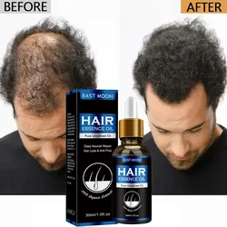 Hair Growth Oil Fast Hair Growth Effective Baldness Repair Hereditary Hair Loss Postpartum Hair Loss Seborrheic Hair Loss