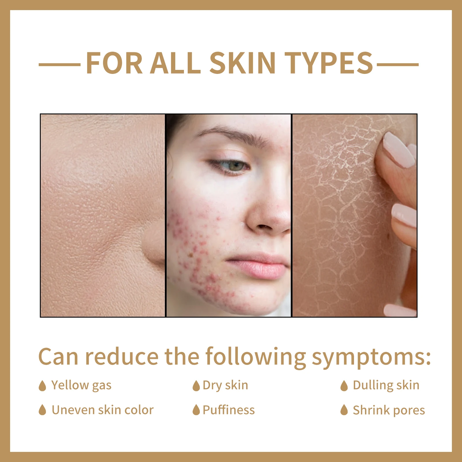 skin types , Organic Rice Toner Solution to Soften, Brighten, and Moisturize Face