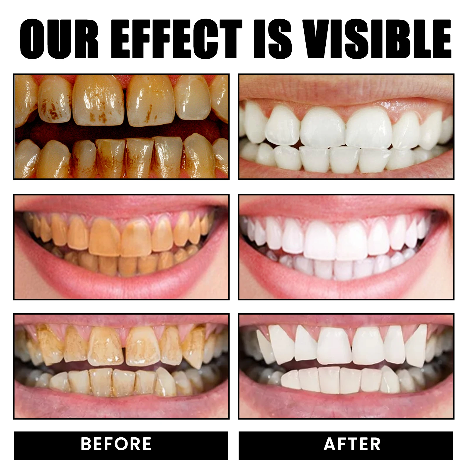 Oralhoe probiotic whitening toothpaste,Oral cleaner,Tooth Color Correction,Care For Oral Health Teeth Whitening Toothpaste