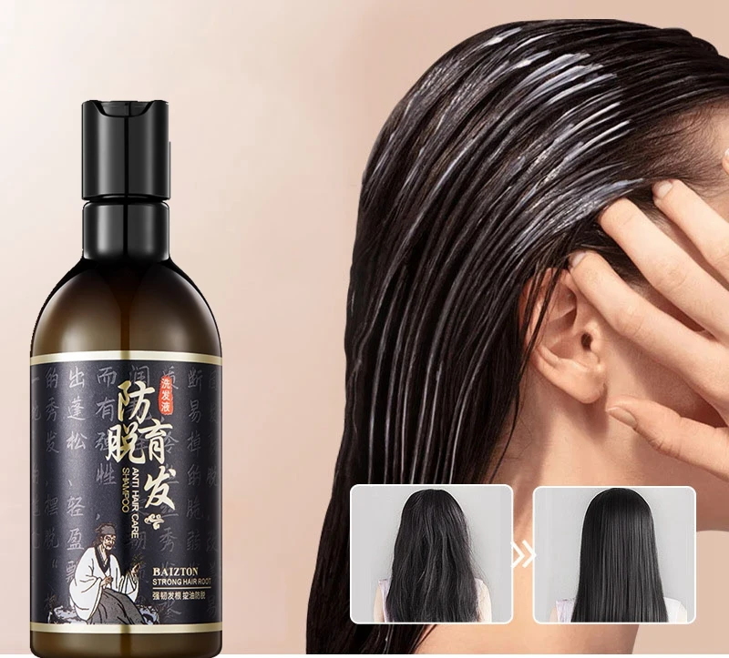 250ml Hair Growth Shampoo Anti Hair Loss Shampoo Hair Care Products Hair  Regrowth Treatment Conditioner Thickener For Women Men| | - AliExpress