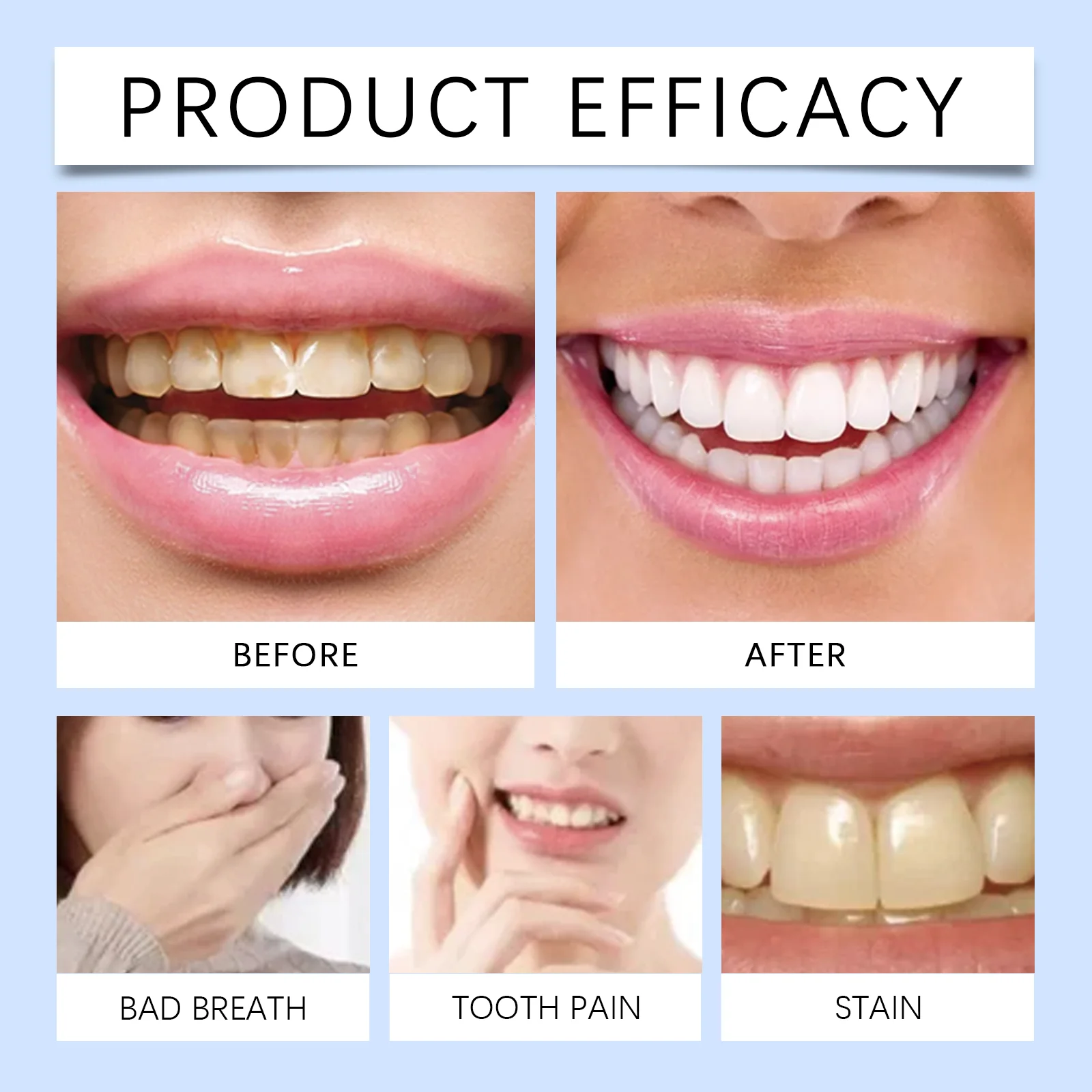 120ml ORALHOE Mouthwash Oral Rinse Remove Food Residues Bad Breath Reduce Tonsil Stone Eliminate Odor Breath Oral Care - 6