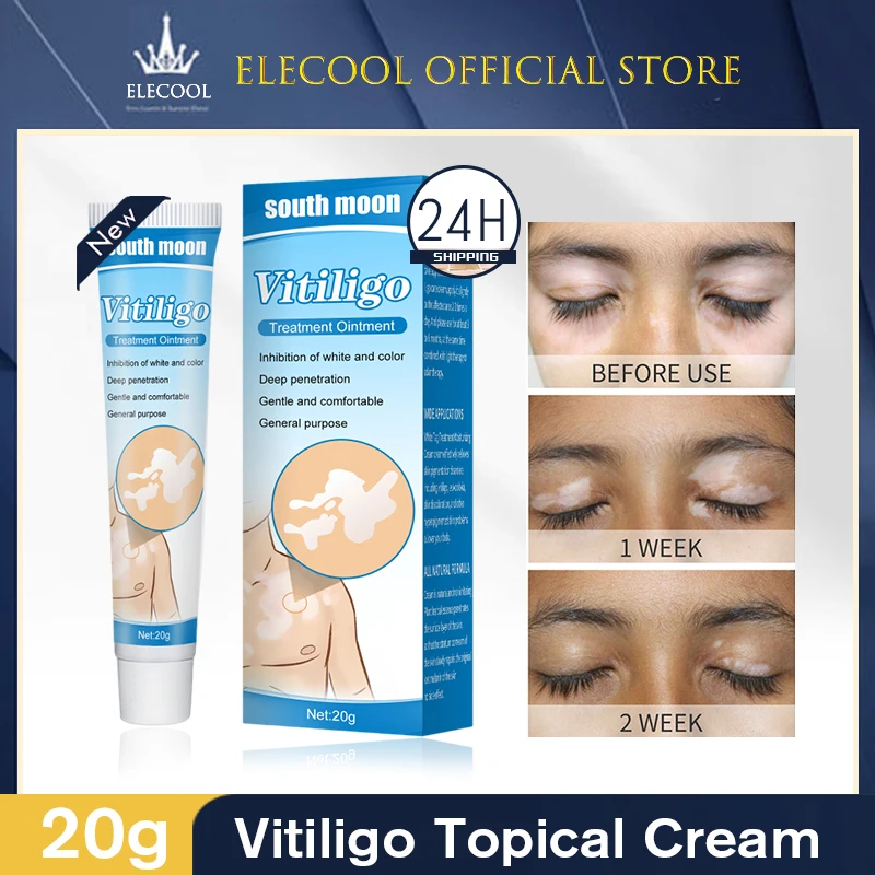 White Spots On Face Possible Causes And Medical Treatments White Tag 