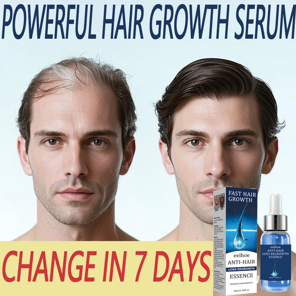 Reduces Hair Fall Nourishes the Scalp Powerful Hair Growth Serum Strengthens hair and adds shine Deeply moisturizes & nourishes