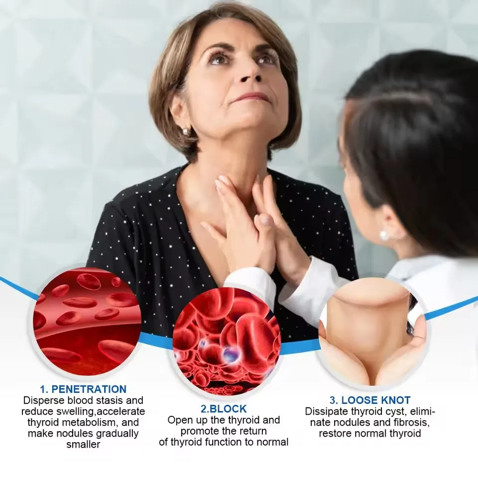 60 PCS Thyroid Gland Care Patches Lymphatic Detox Patch Painless Treatment Heating Neck Anti Swelling Lymph Node Patches