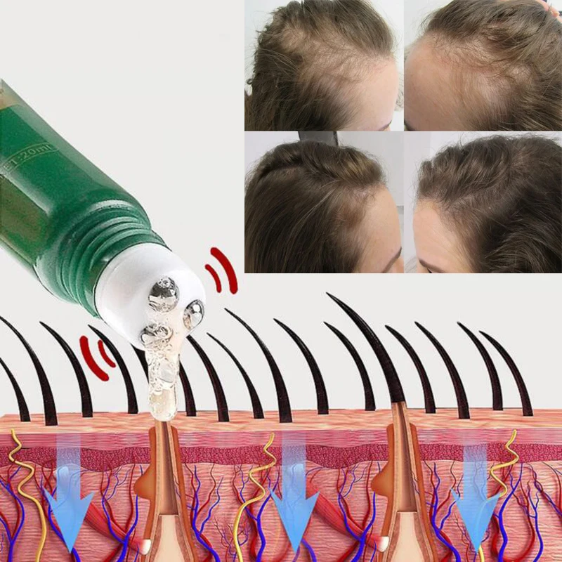 Biotin Fast Hair Growth Oil Hair Regrowth Serum Hair Thinning Treatment