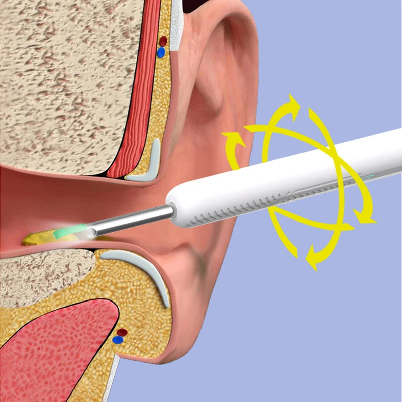 Smart Visual Ear Cleaner with Camera Ear Sticks USB C Charging Ear Wax Removal Tool WIFI Connection 6 LED Lights Earpick