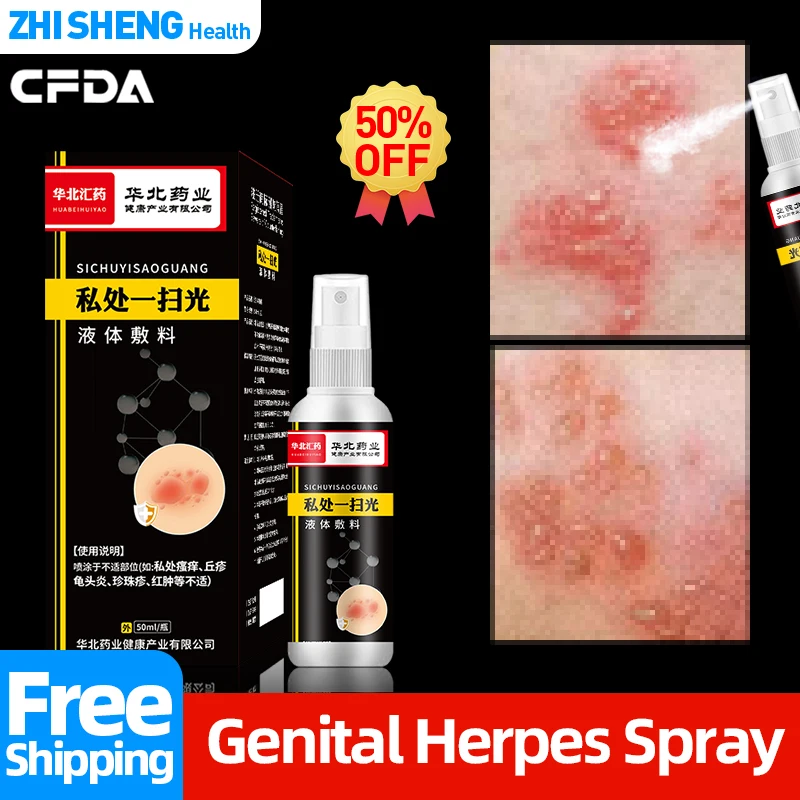 Herpes Treatment Spray Genital Herpes Simplex 50ml/bottle for Men and Women CFDA Approval Shingles Cure Chinese Medicine