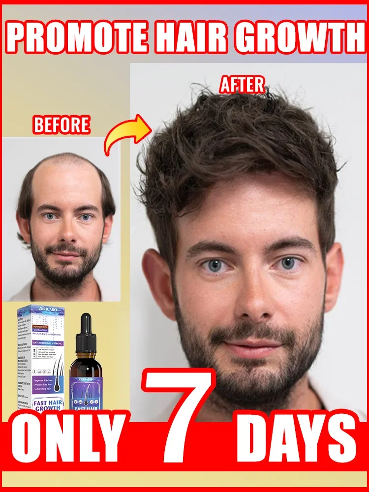 

Unisex Growth Oil Hair Loss Treatment Rapid Hair Growth Effective Baldness Repair Hereditary Postpartum Hair Loss