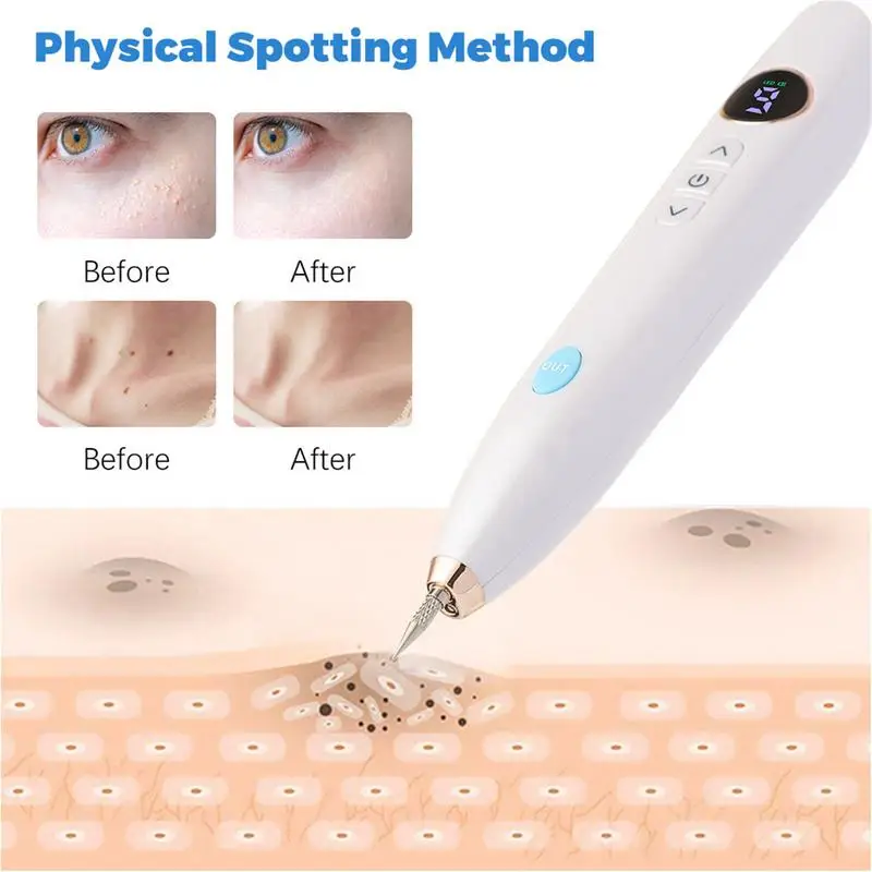 9 Level Electric Freckle Skin Mole Dark Spot Remover Pen Skin Tag Remover Dark Spot Wart Speckle Tattoo Removal Pen Plasma