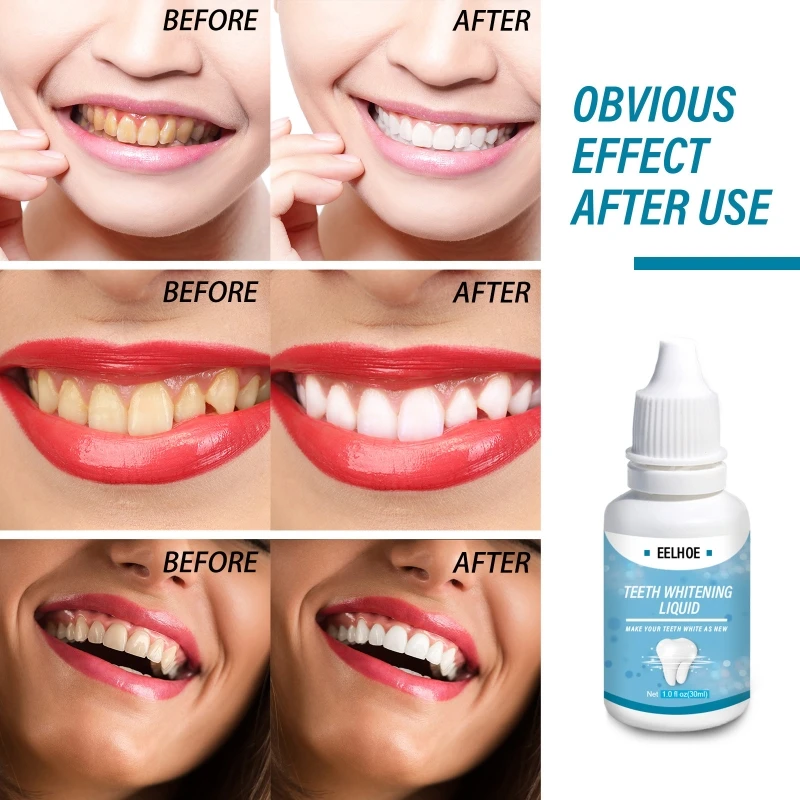 Teeth Whitening Essence Liqud Oral Hygiene Cleaning Whiten Tooth Serum