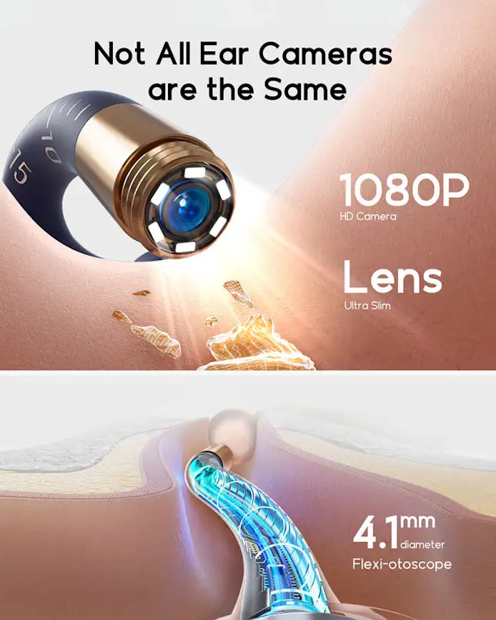 Bebird Visual Earwax Removal Kit With Hd Camera And Tweezers_voghion.com