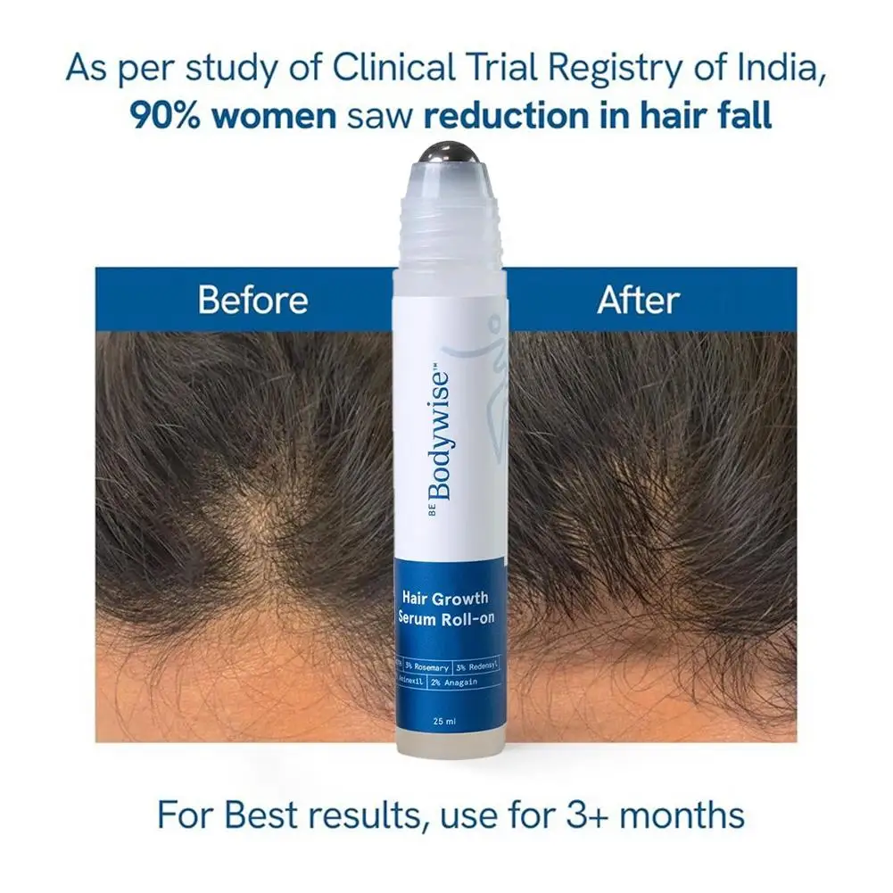 Siero per la crescita dei capelli al rosmarino da 25 ml al 3% - Nutrimento profondo del cuoio capelluto Controllo dell'effetto crespo Rafforza le radici dei capelli Olio essenziale per la cura dei capelli - immagine 2
