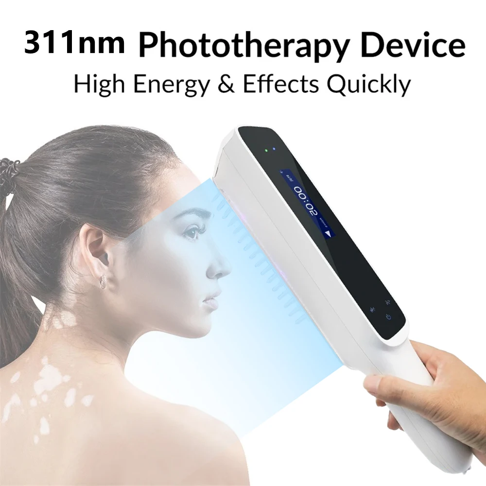 UV 311nm Ultraviolet Phototherapy Device 311nm UVB Lamp To Treat Vitiligo, Psoriasis, White Spots And Skin Disease - Image 3
