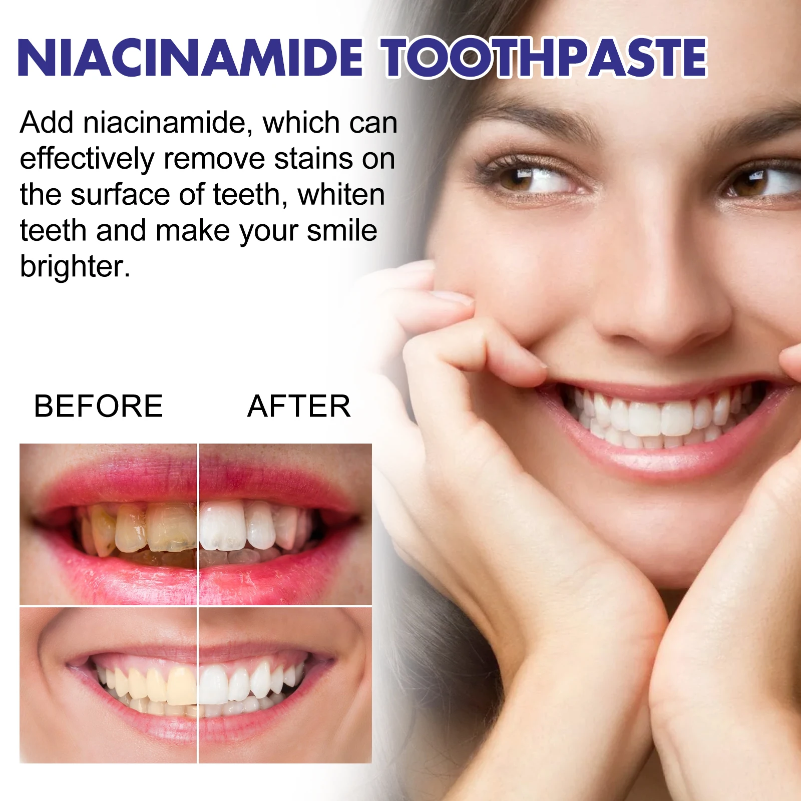 Eelhoe Nicotinamide Toothpaste Removes Tooth Stains Tartar Dazzler Toothpaste Freshens Breath Clean Mouth Brightening Toothpaste