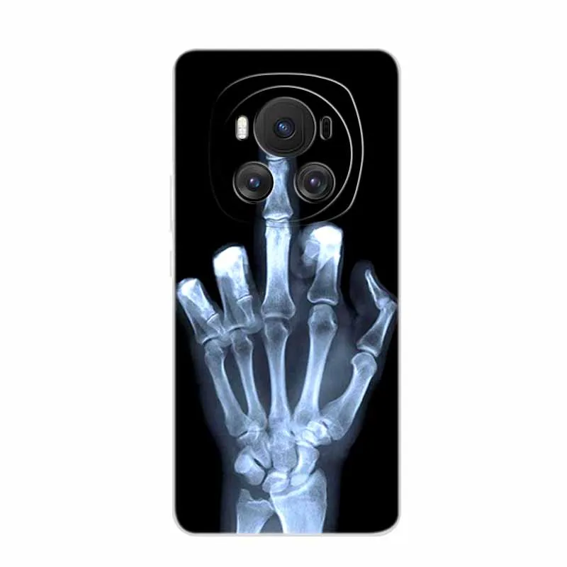 Fashionable Clear Animal Design Silicone Phone Case - Soft TPU Back Cover