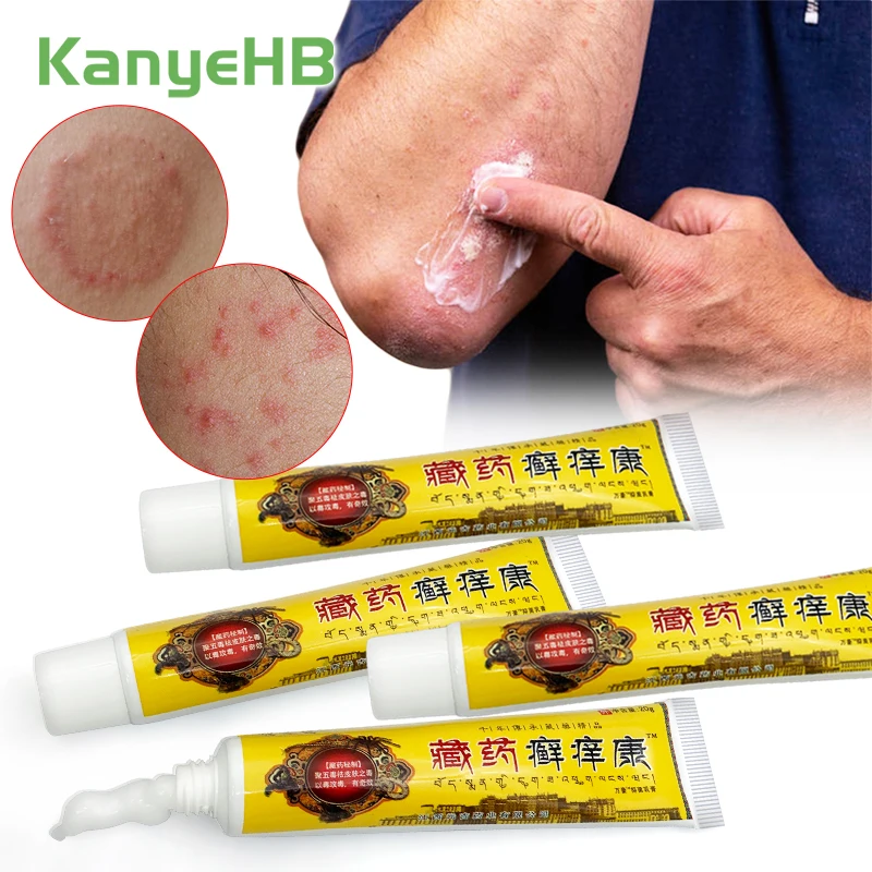 

1-3-5pcs Antibacterial Skin Cream Dermatitis Jock Itch Psoriasis Cream Pityriasis Eczema Ointment Anti-itch Anti-inflammatory