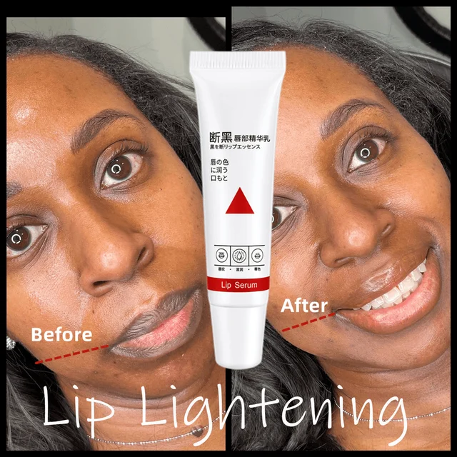 Naturally Pink Serum Lips Lightening Dark Lip Bleaching Cream Black