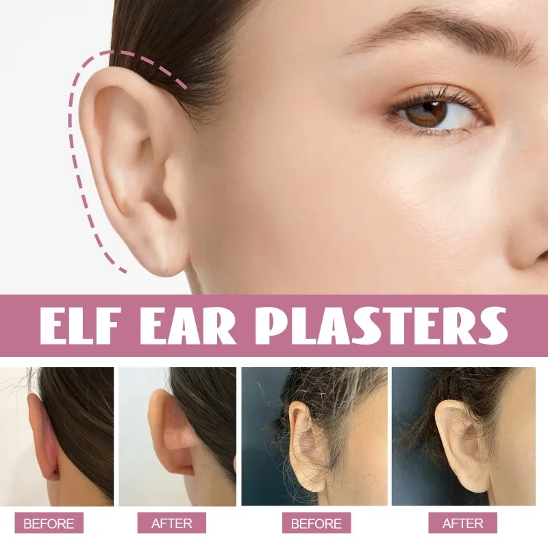 Ear Corrector Elf Ear Plasters Invisible Ear Stickers for Big Ear  Protruding Ear Solution Waterproof Elf Ear Patches Beauty Tool - AliExpress
