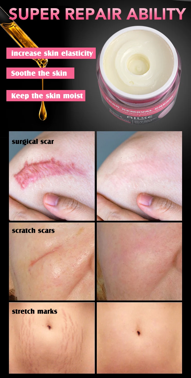 If a cut/scratch scar doesn't fade after a month, is it permanent? - Quora