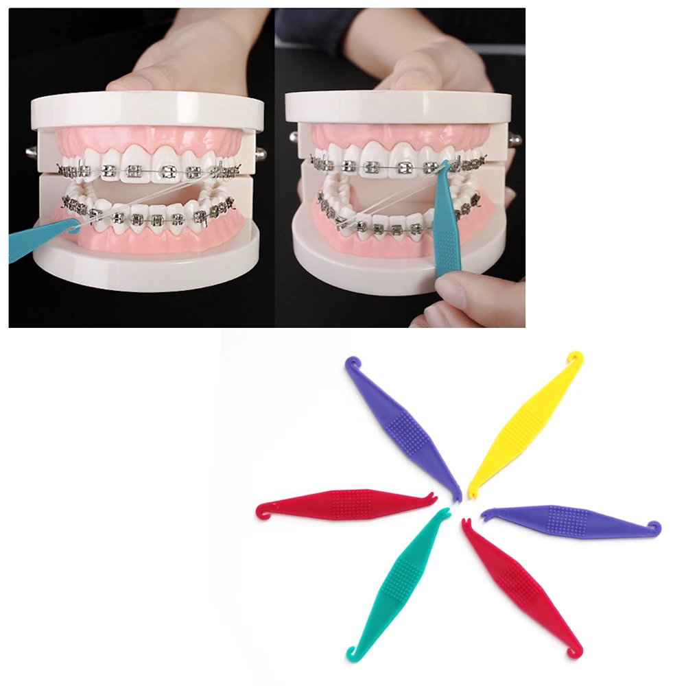 

100 шт., пластиковые зубные эластичные ленты (случайный цвет)