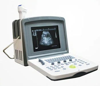 Portable Ultrasound Machine & Laptop Ultra Sound Scanner