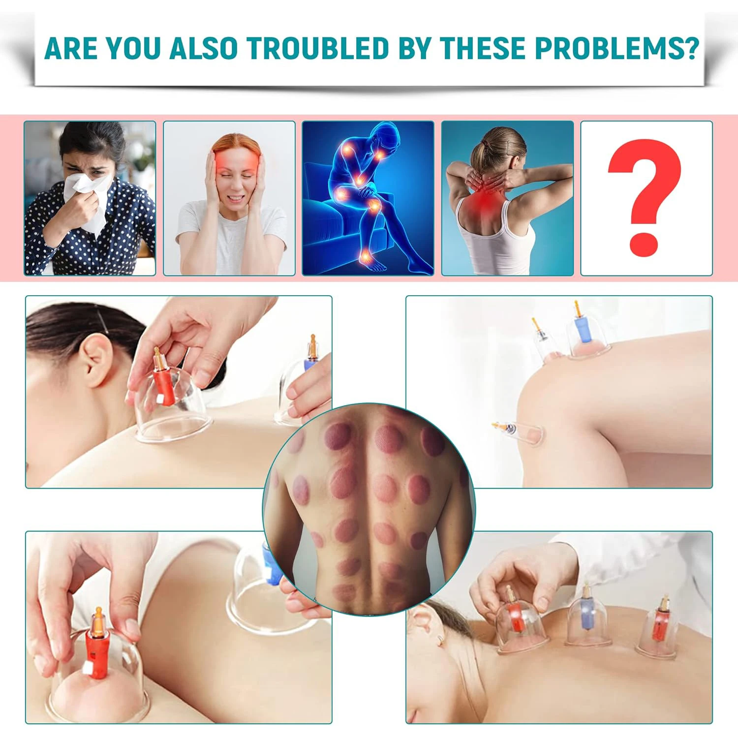 32 PCS Vacuum Cupping Massage Device Acupuncture Suction Cup Set Chinese Medicine Physiotherapy Anti Cellulite For Body Massager