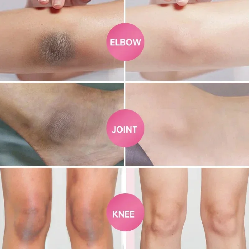 Mydło wybielające ciała głębokie rozjaśnianie skóry peeling do ciała kolan intymne części pod pachami białe odżywcze mydło pielęgnacyjne
