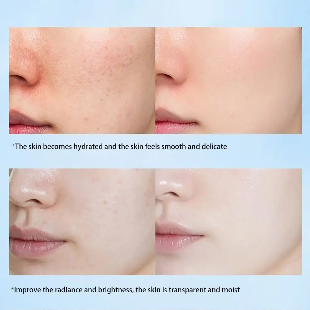 Acetyl Hexapeptide-8 Anti-wrinkle Face Skin 