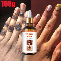 Fast Whitening Cream Intense Stains Remover Dark Knuckles Hand Knuckle Elbows Knee Melanin Corrector Serum Beauty Care Products