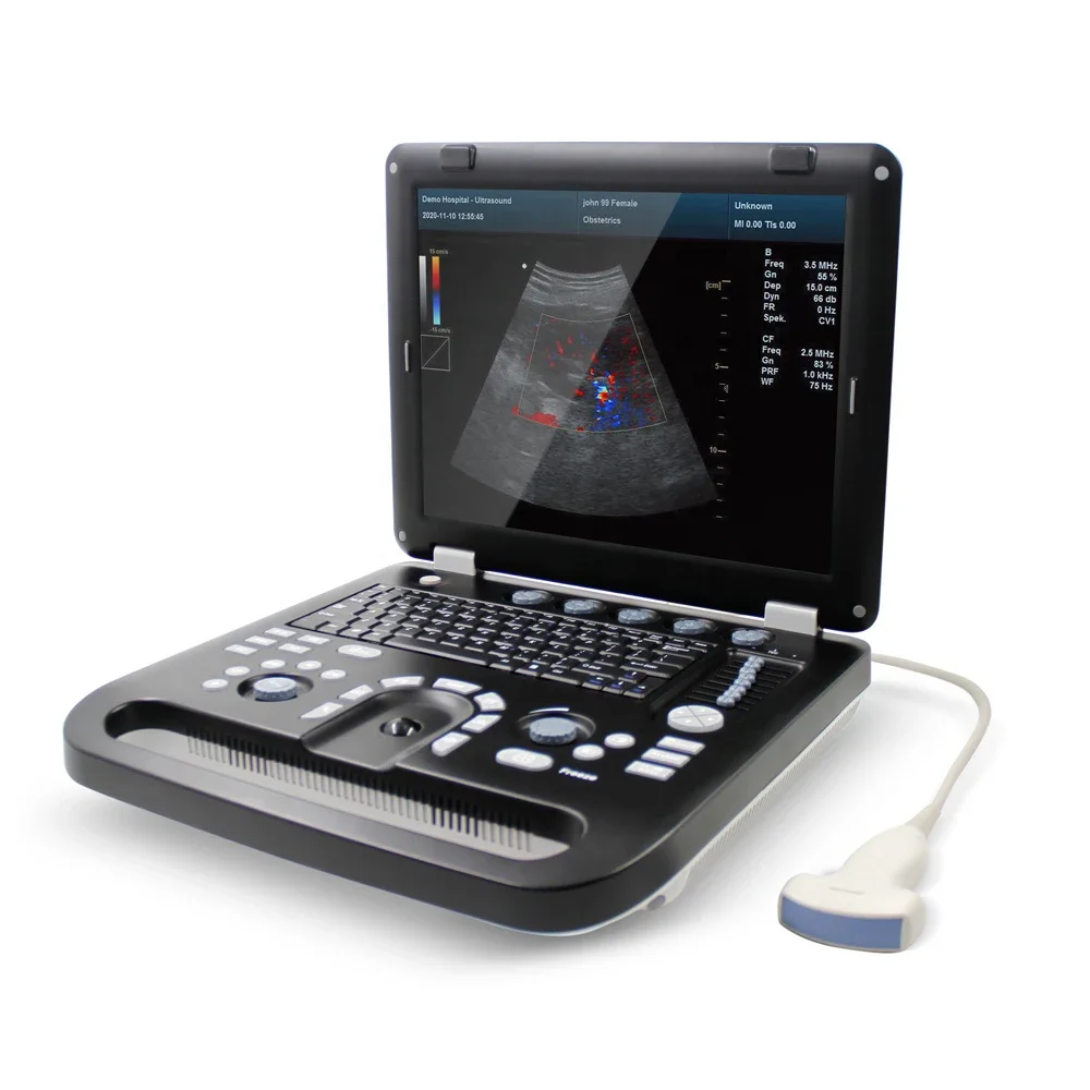 Портативная ультразвуковая ветеринарная