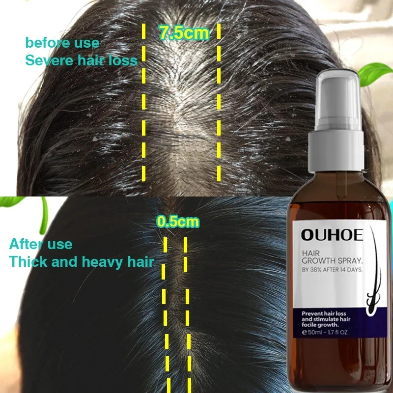 

50ml Hair Growth Spray Prevent Hair Loss Fast Growing Hair Care Essential Oil Repair Damaged Beauty Health Product for Men Women