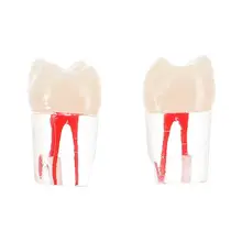 

2pcs Dental Root Canal Model Dental Root Model for Dentist Teaching Learners