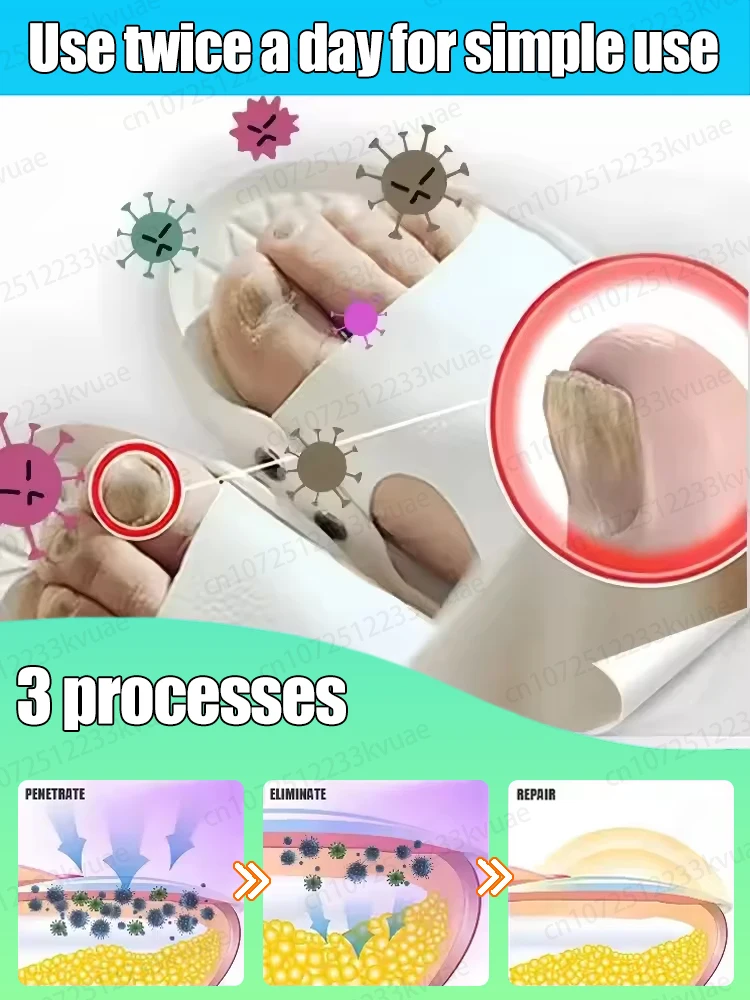 2026년 히트 상품. 네일 아트용 라스터 데코레이션. 재발 없음.