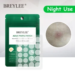 BREYLEE Acne Pimple Patch Acne Treatment Stickers Pimple Remover Tool Blemish Spot Skin Care Face Mask Acne Cream Night Use