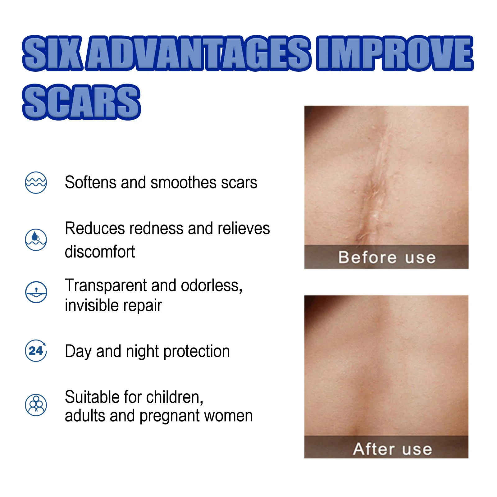 Stretch Mark Removal Essential Oil Pregnancy Lift Maternity Repair Fade Cesarean Section Scald Burn Surgical Scar Health Care