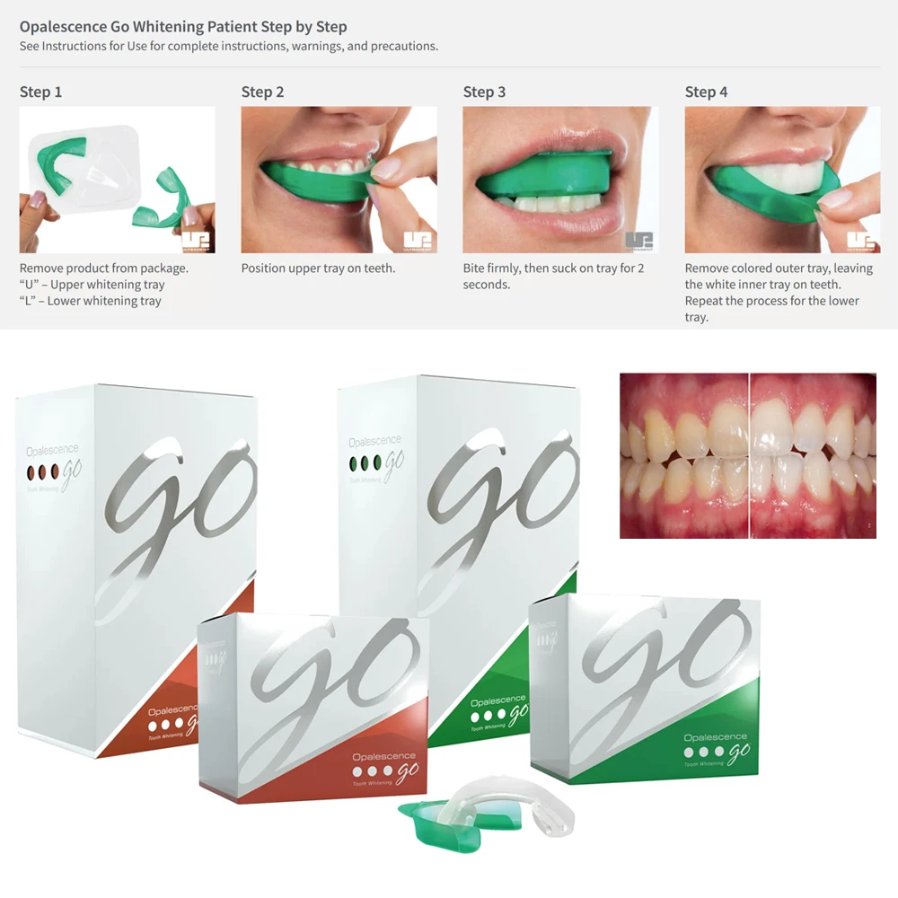 Opalescence Go Teeth Whitening Trays Prefilled At Home Take Patient Kit  American Ultradent 15% 15 Percent HP Gel Professional - AliExpress