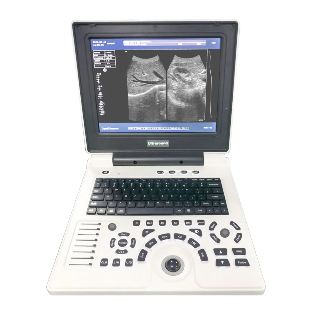 

Pet Diagnostic Equipment Laptop Portable Dog Cat Cow Ultrasound Machine